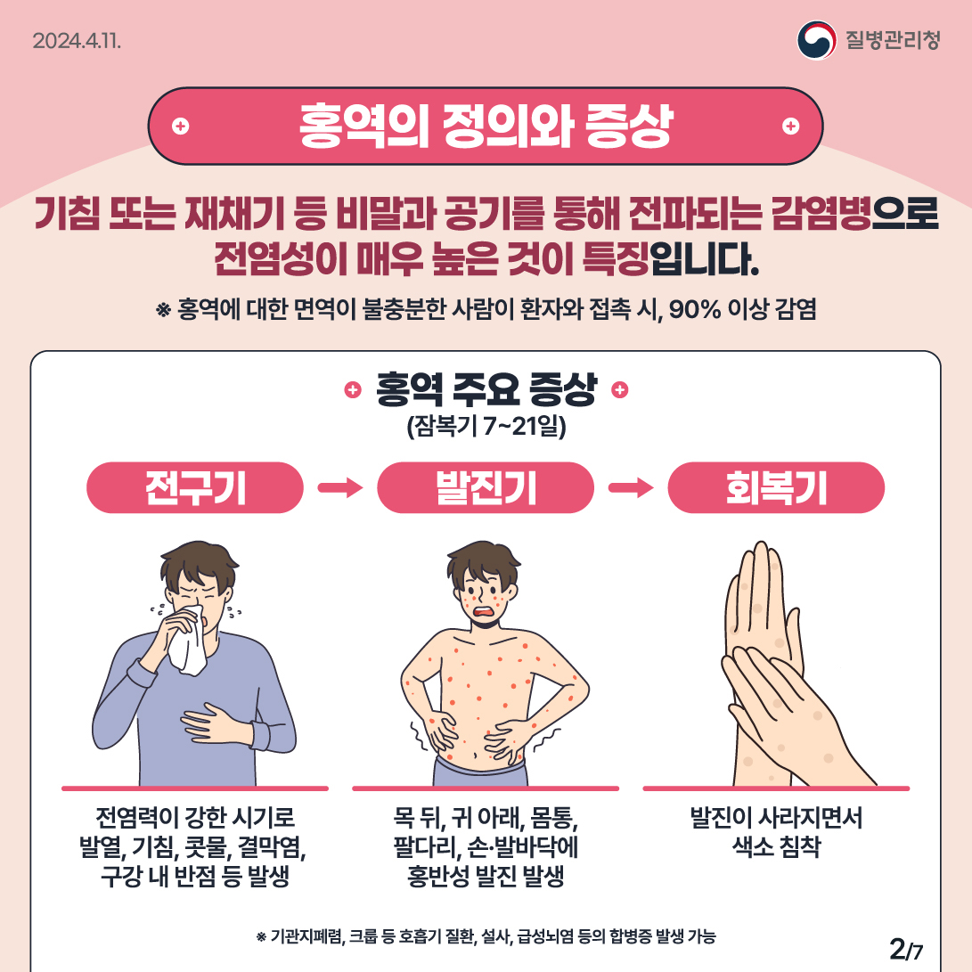 외국인 유학생 홍역 감염 관련 안내